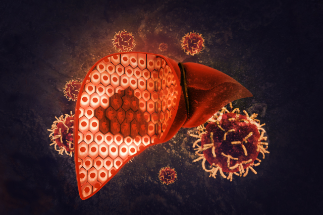 Liver Cancer